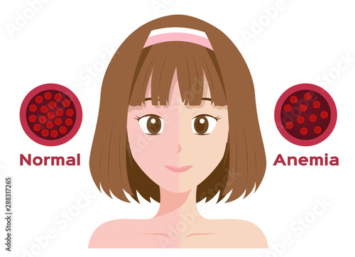 anemia vector . low red blood cell icon / women