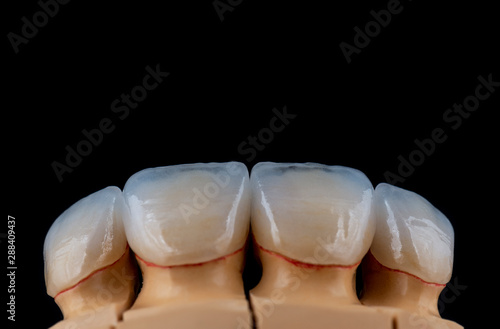 4 units natural color press ceramic veneers