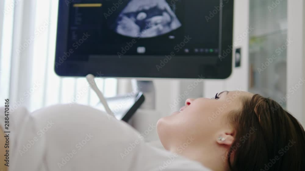 Pregnant woman on utltrasonographic examination at hospital Pregnant woman on utltrasonographic examination at hospital