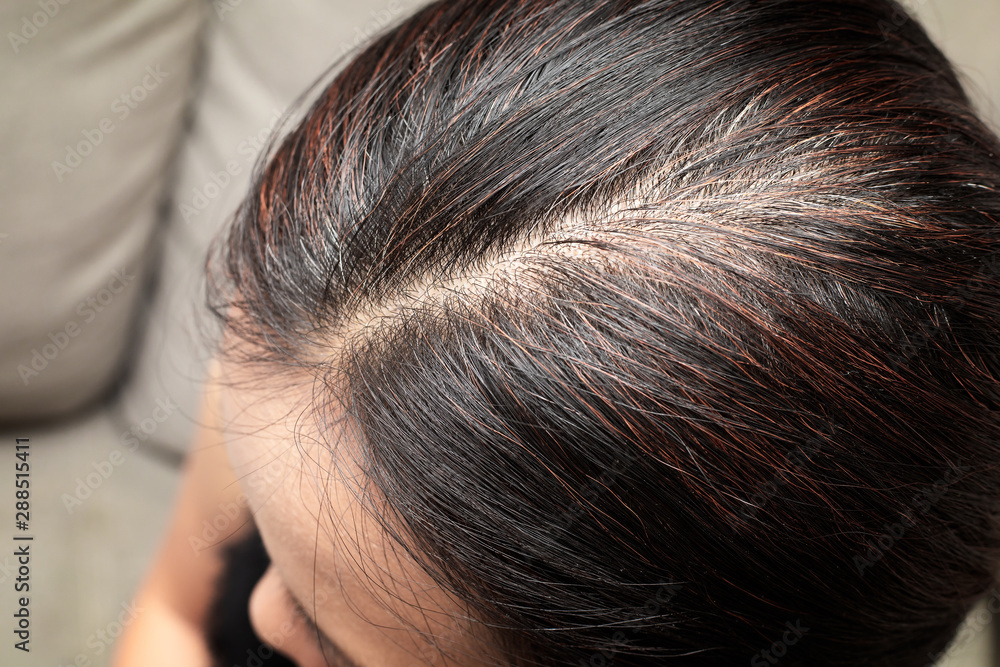 Close up of white hair in asian woman. common problem of woman Close up of white hair in asian woman. common problem of woman