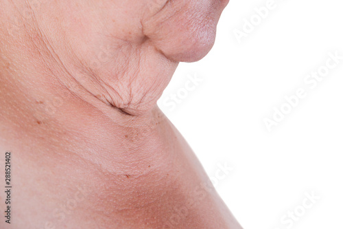 Flabby skin on the neck of an elderly woman isolated on white background