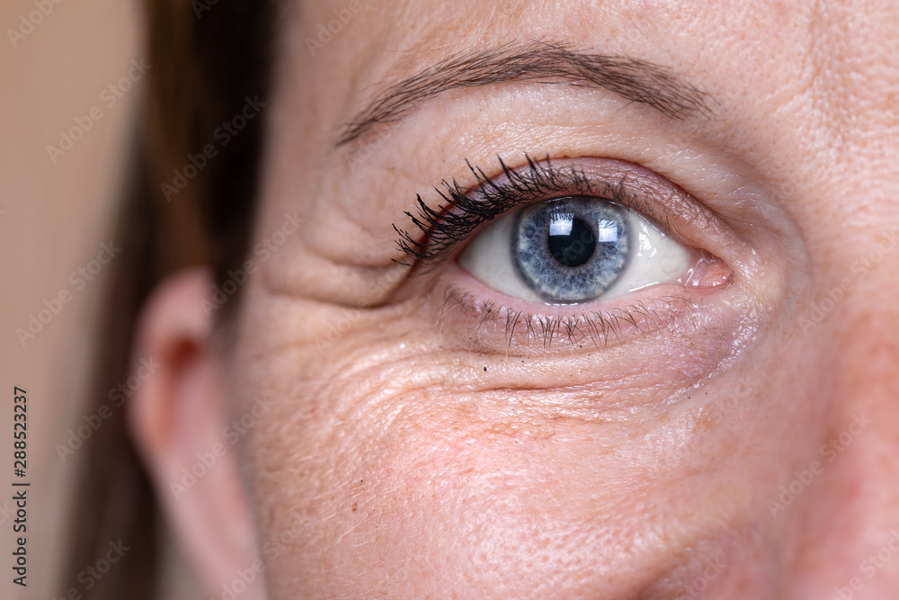 Obraz premium A close up and front view on the blue eye of a mature caucasian woman in her forties, showing heavy wrinkles (crow's feet) in the corner and below the eye, with copy-space.