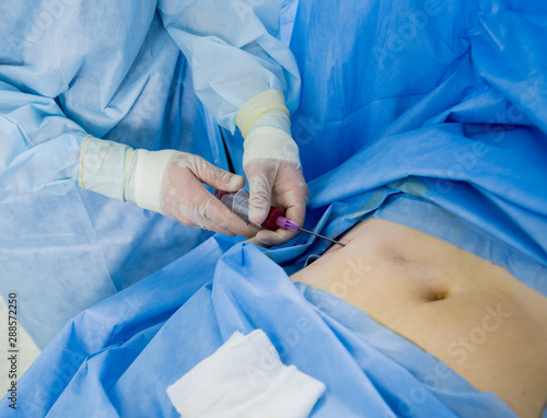 Arthroscope surgery. Orthopedic surgeons in teamwork in the operating room with modern arthroscopic tools.