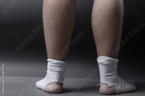 back of standing feet with white socks and a big hole in front of grey background