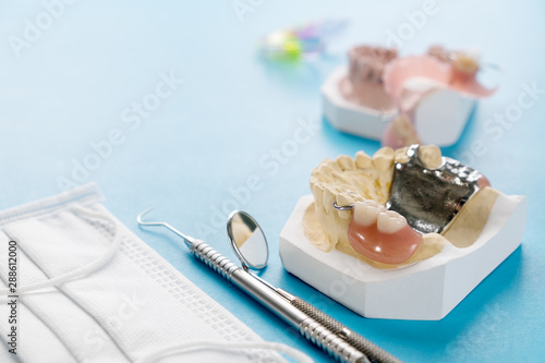  Removable partial denture (RPD.) on blue background. photo