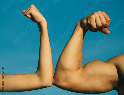 Competition, strength comparison. Vs. Fight hard. Health concept. Hand, man arm, fist. Musclar arm vs weak hand. photo