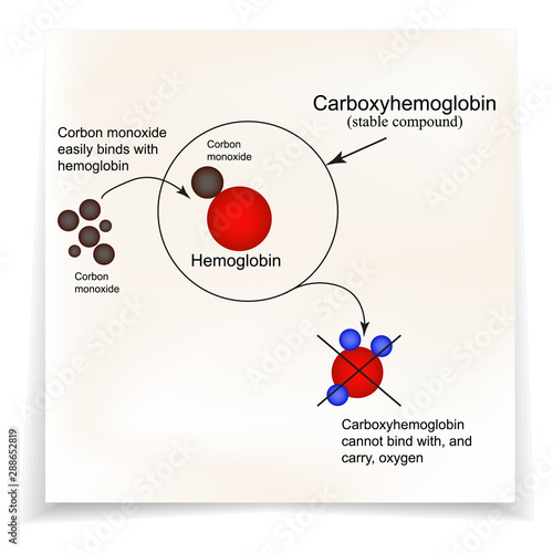 Carboxyhemoglobin. Joining the hemoglobin carbon monoxide. The inability to transport oxygen. Carbon monoxide poisoning. Infographics. Vector illustration