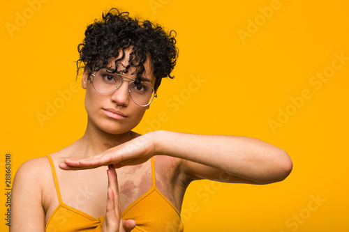 Young african american woman with skin birth mark showing a timeout gesture.
