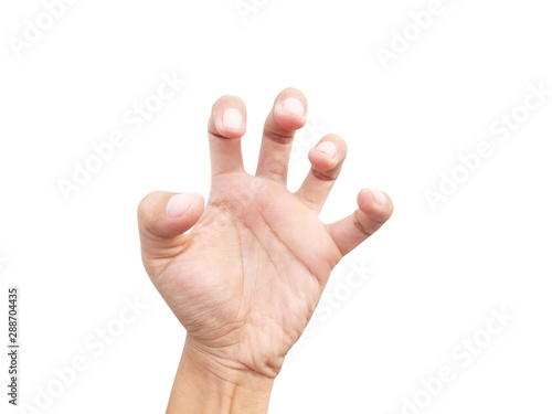 Spasticity of the hand and fingers Caused by epilepsy isolated on white background.