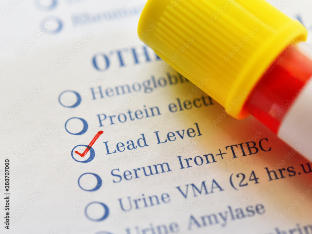 Ταπετσαρία Test tube with blood sample for lead level test