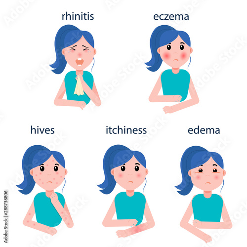 A girl with various manifestations of allergies. Allergy symptoms-eczema, rhinitis, urticaria, swelling, itching. Vector graphics