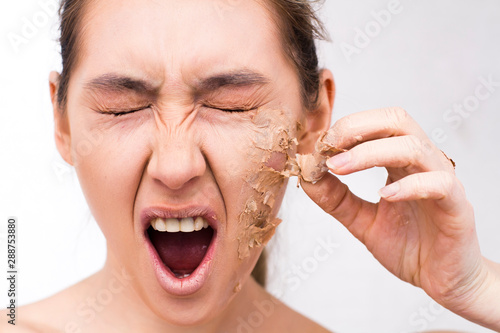 Closeup woman portrait. A young woman has flaky skin on her face. A woman screams in pain.