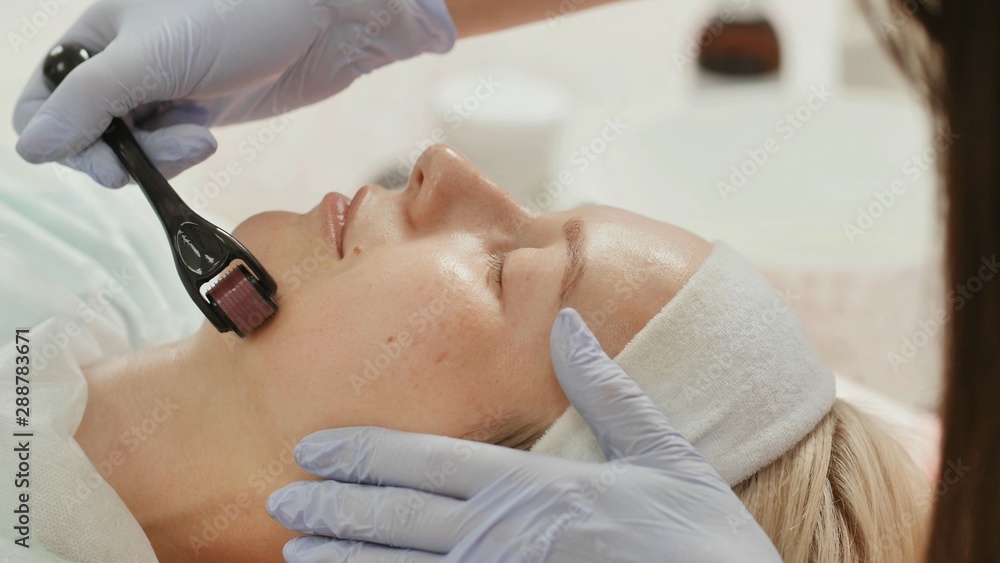 Close-up portrait of woman having beauty skin treatment. Therapist preparing skin with derma roller. Close-up portrait of woman having beauty skin treatment. Therapist preparing skin with derma roller.