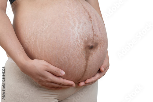 Belly of a pregnant woman with stretch marks on white background.
