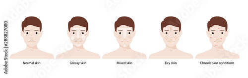Men`s types of skin: normal, greasy, mixed, dry skins and chronic skin conditions