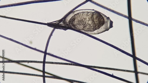 Lice egg attached to the hair, video taken with a high magnification microscope.