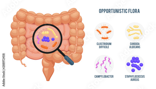 Realistic flat vector illustration:intestine, gut microflora infographic. Cartoon illustration isolated on white. Opportunistic flora:Clostridium Difficile, Candida, Campylobacter, Staphylococcus