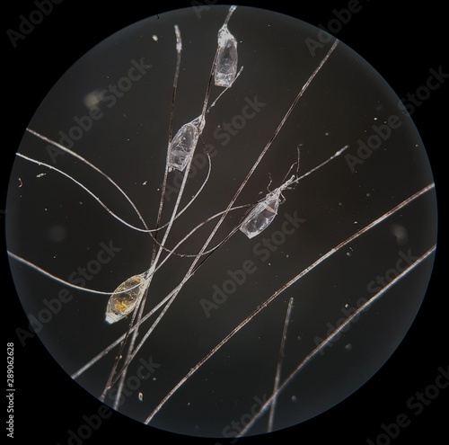  lice invasion, photo of lice eggs on hair under high magnification