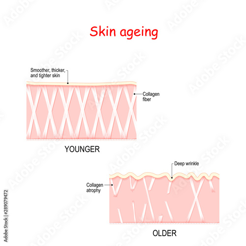 Visual representation of skin changes over a lifetime
