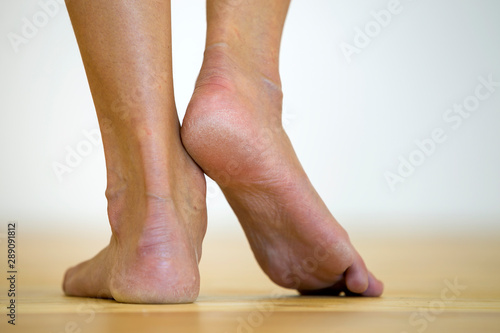 Woman bare feet on the floor. Legs care and skin treatment concept. © bilanol