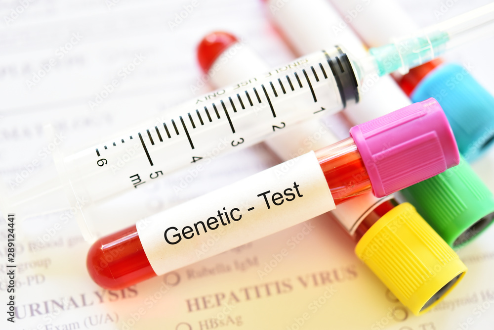 Test tube with blood sample for genetic testing