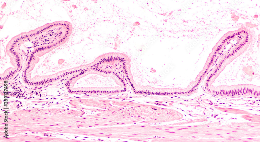 Simple Columnar Epithelium Gallbladder