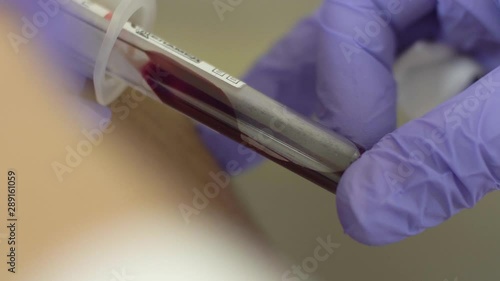 Blood sampling on coronavirus wuhan city. Blood sample for blood test in blood testing laboratory. Anxious female patient in fear for blood. Stress concept.