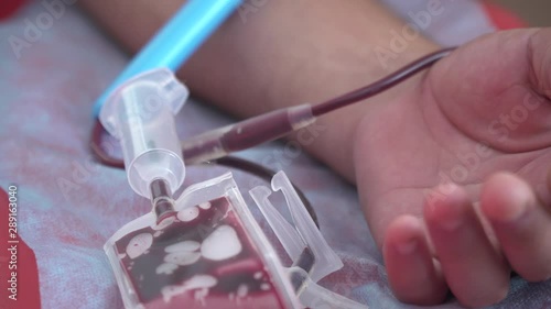 DONETSK, UKRAINE -  September 09, 2019:  Blood transfusion station, donation.