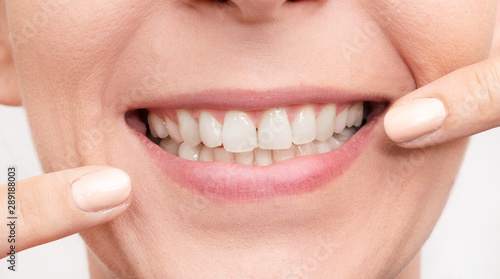 Smiling woman mouth with white teeth