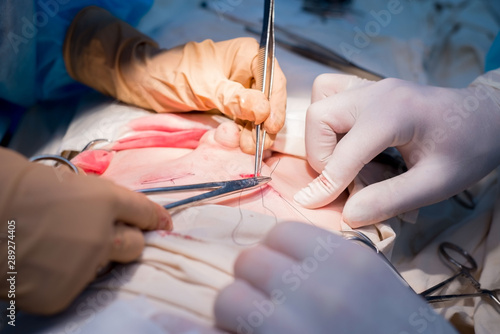 surgical suture. The hands of the surgeon and assistant in a sterile operating room impose a cosmetic suture on the skin of the patient's child.
