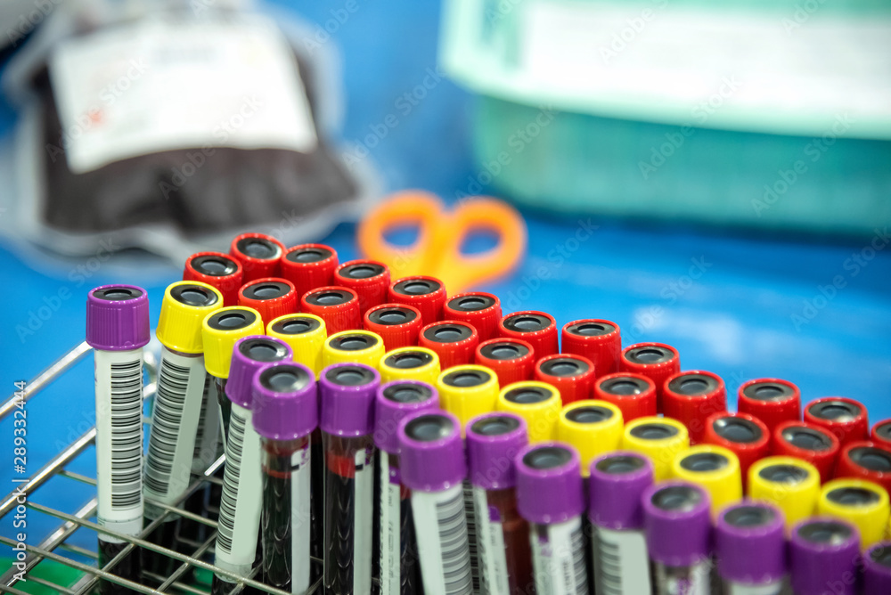 Rack of blood tubes with barcode labels for proper identification with