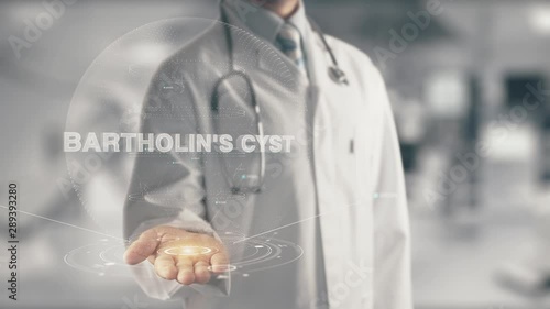 Doctor holding in hand Bartholin's Cyst photo