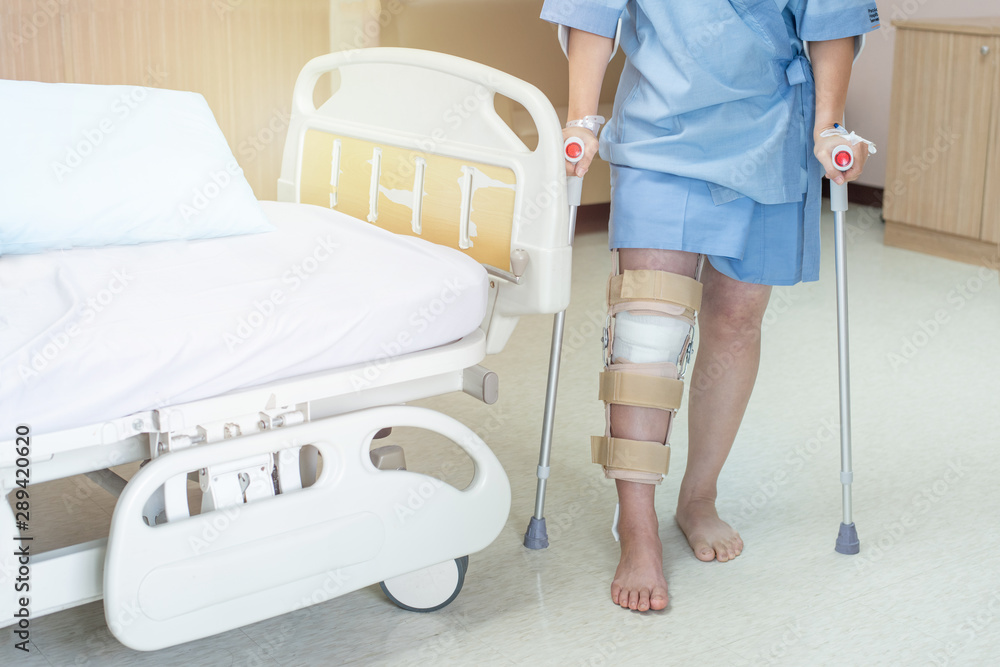 Asian woman patient with knee brace and walking stick in hospital ward after  ligament surgery. Stock Photo