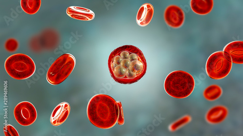 Red blood cells infected with malaria parasite, 3D illustration showing Plasmodium parasites inside red blood cells in the stage of schizont