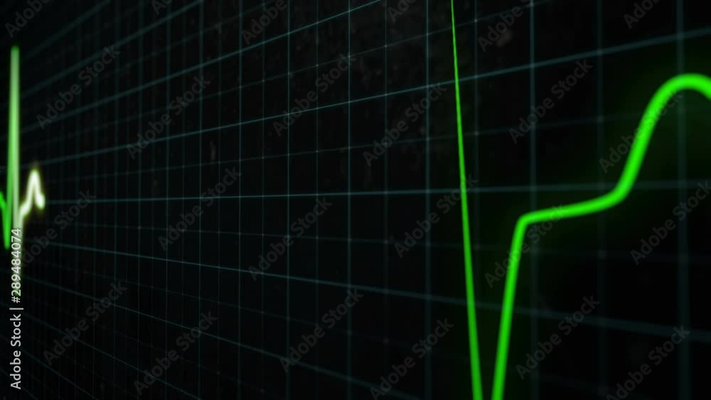 Heart rate chart, a medical screen of healthy heart rate in close-up, seamlessly loop footage. A bright green line shows the heart rate in real-time on monitor with grid lines. Heart rate chart, a medical screen of healthy heart rate in close-up, seamlessly loop footage. A bright green line shows the heart rate in real-time on monitor with grid lines.