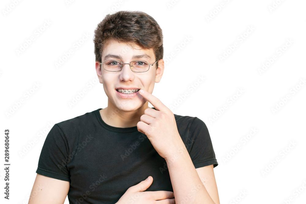 The guy with braces on his teeth smiles on a white background and points his finger at his white teeth with braces The guy with braces on his teeth smiles on a white background and points his finger at his white teeth with braces