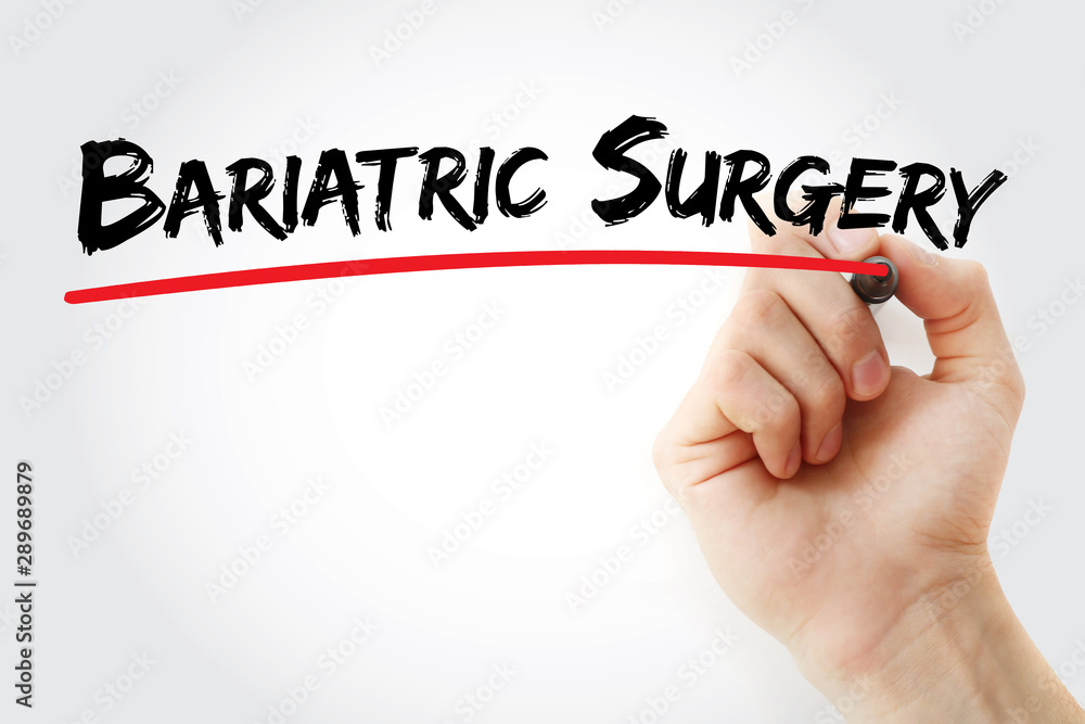 Fototapeta premium Bariatric Surgery text with marker, medical concept background
