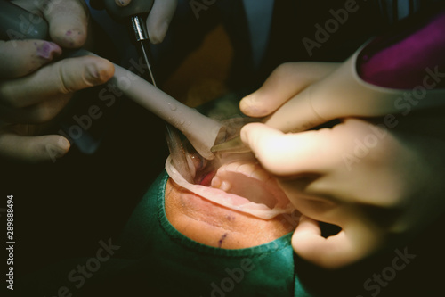Dental care check up, Dentist examining and doing teeth treatment in dental clinic, Yearly visit for teeth cleaning and scaling to prevent gum disease problems, Healthy oral hygienic.