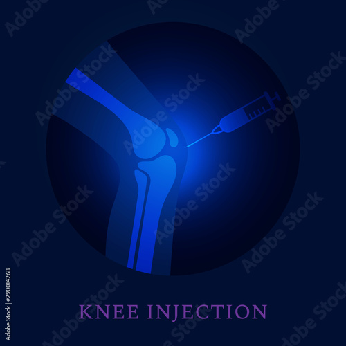 Knee joint injection treatment.  Person suffering from pain and arthritis disease. Human body anatomy 3D icon. Orthopedic medical concept. Isolated vector illustration.