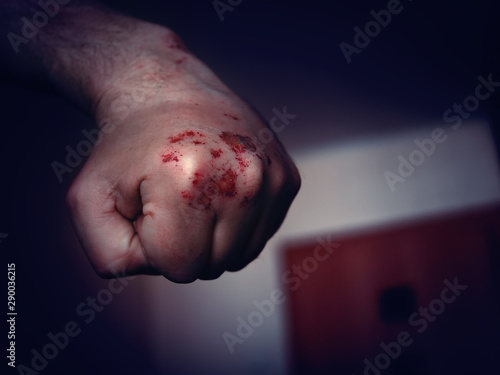 Clenched Left Hand Fist with Bloody and Bruised Knuckles Prepared to Punch Again. Domestic Violence, Abuse or Family Violence Concept. photo