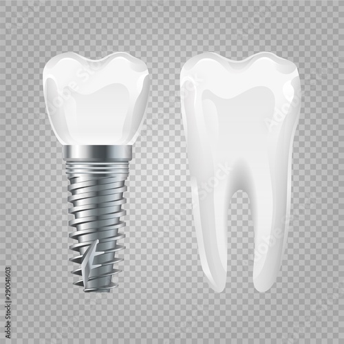 Dental implant. Realistic healthy tooth and implant. Vector dental surgery elements. Tooth and implant, mouth medicine and healthy treatment illustration