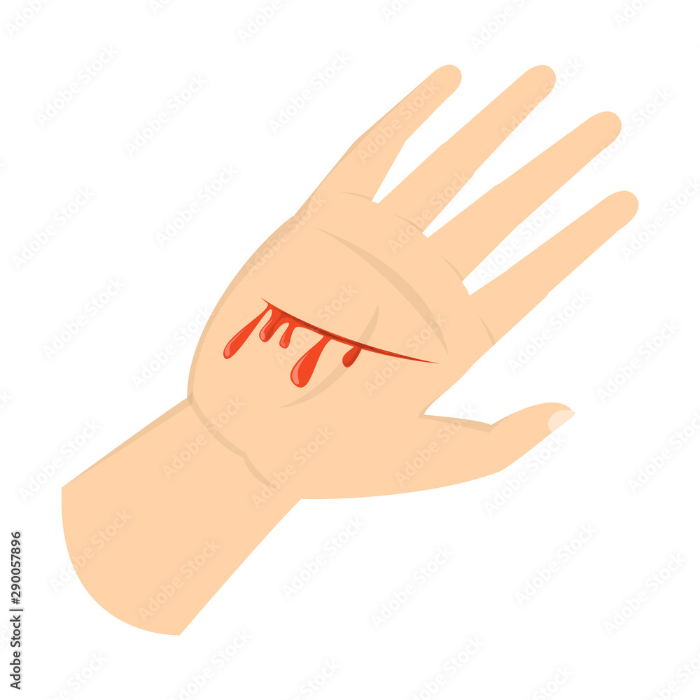 Wound on the hand palm Wound on the hand palm