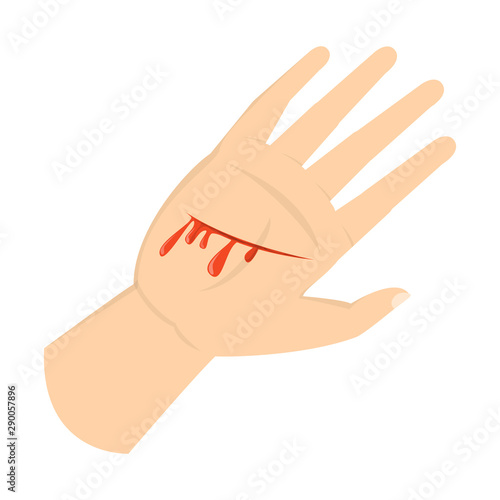 Wound on the hand palm