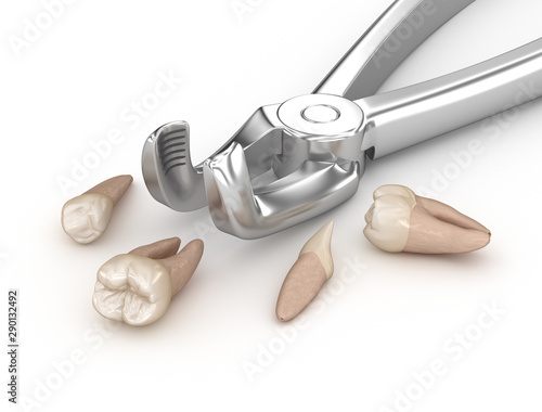 Extraction forceps and teeth, concept 3D illustration. photo