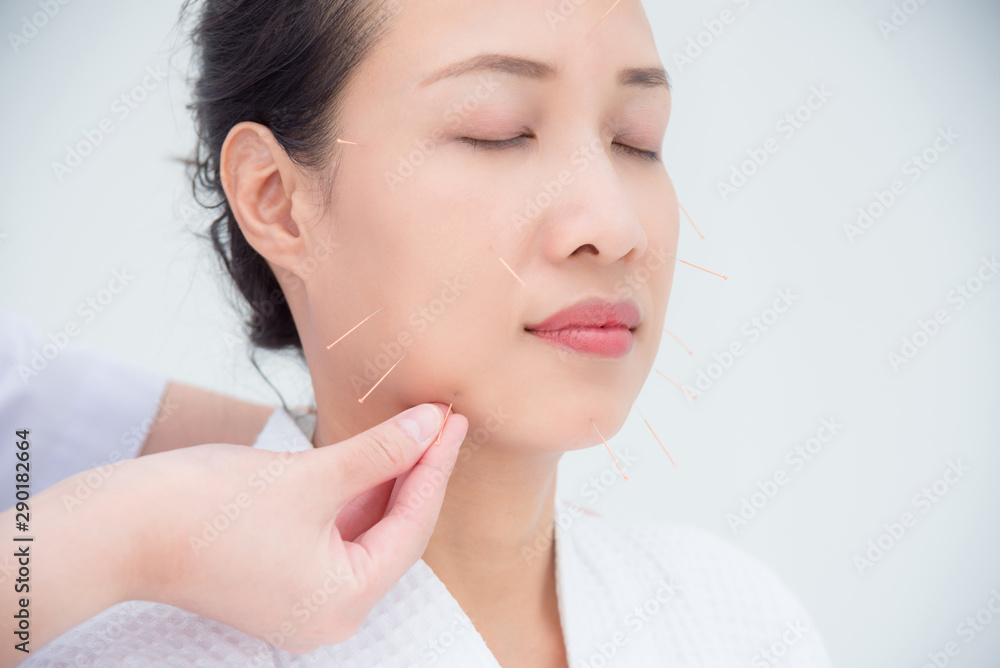 Beautiful asian woman receiving facial acupuncture treatment at clinic ,Alternative medicine concept.