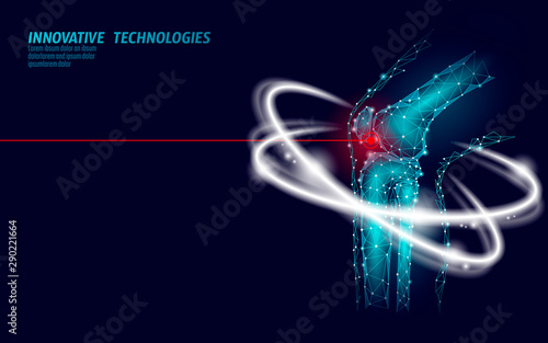 Human knee joint 3d model vector illustration. Low poly design future technology cure pain treatment. Blue background and red injury man body leg medicine template