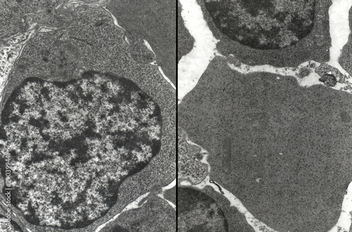 Bone marrow. Erythroblast and reticulocyte photo