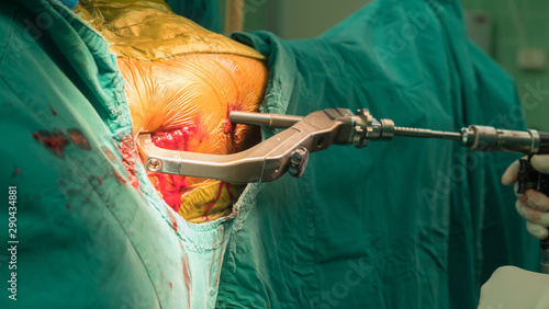 orthopedic surgery