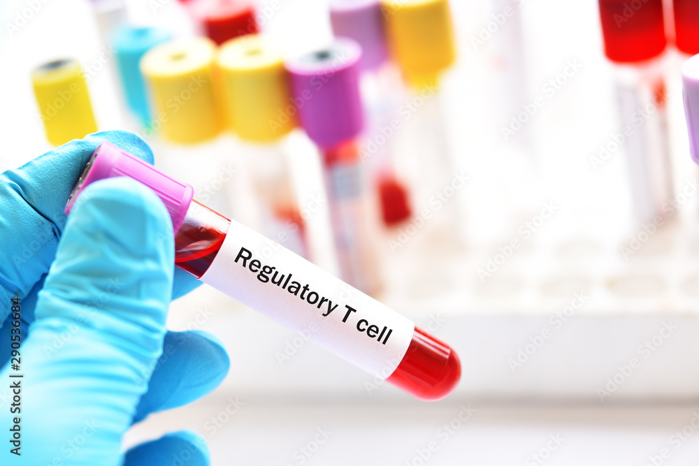 Fototapeta premium Blood sample tube for Regulatory T cells or Treg cells test