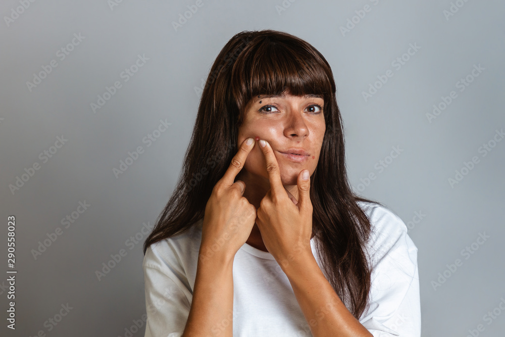 Acne and cosmetology. A tanned young woman squeezes a pimple on her face. Copy space Acne and cosmetology. A tanned young woman squeezes a pimple on her face. Copy space
